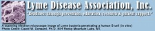 Lyme Disease Association - Module